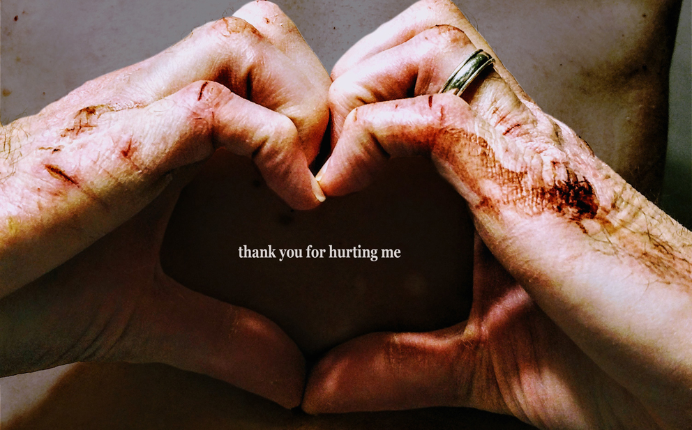 thank you for hurting me
